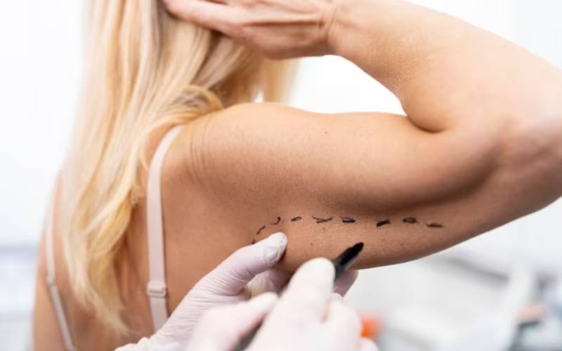 liposuction Washington DC
