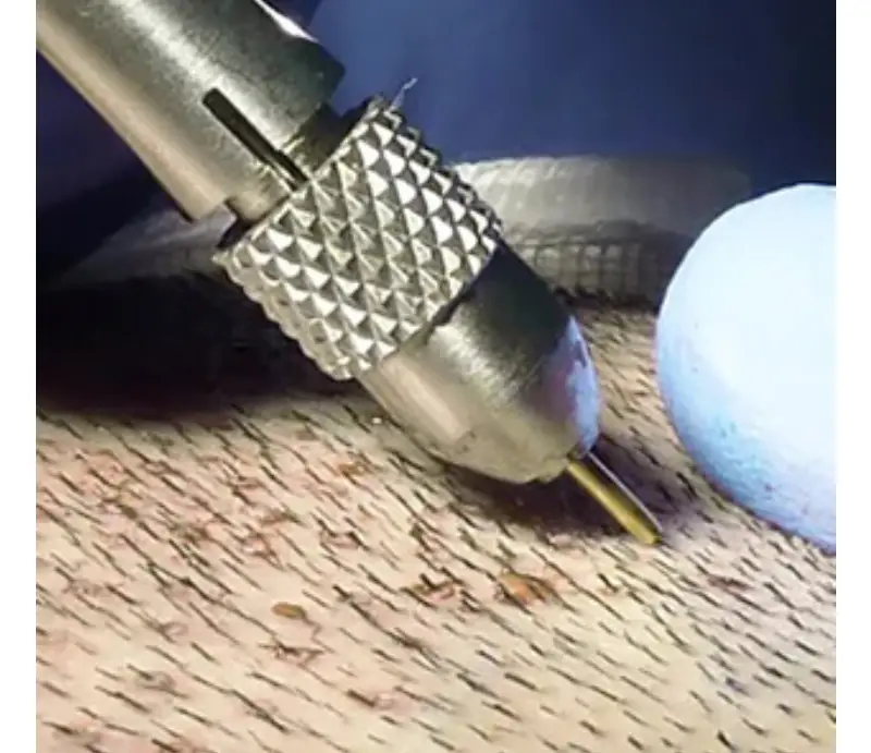 Hair Transplant in Istanbul
